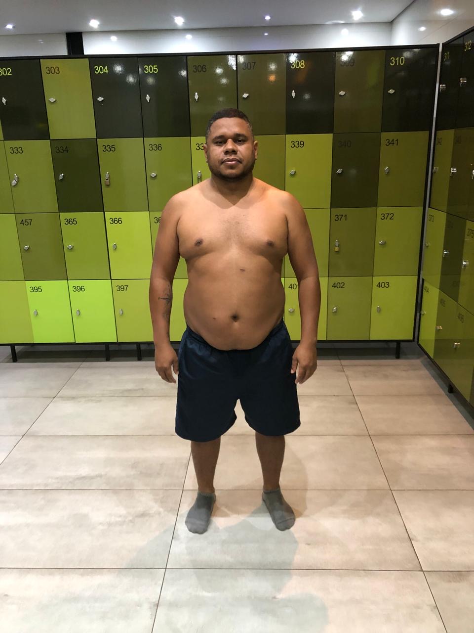 Foto de antes - evolução do paciente 1