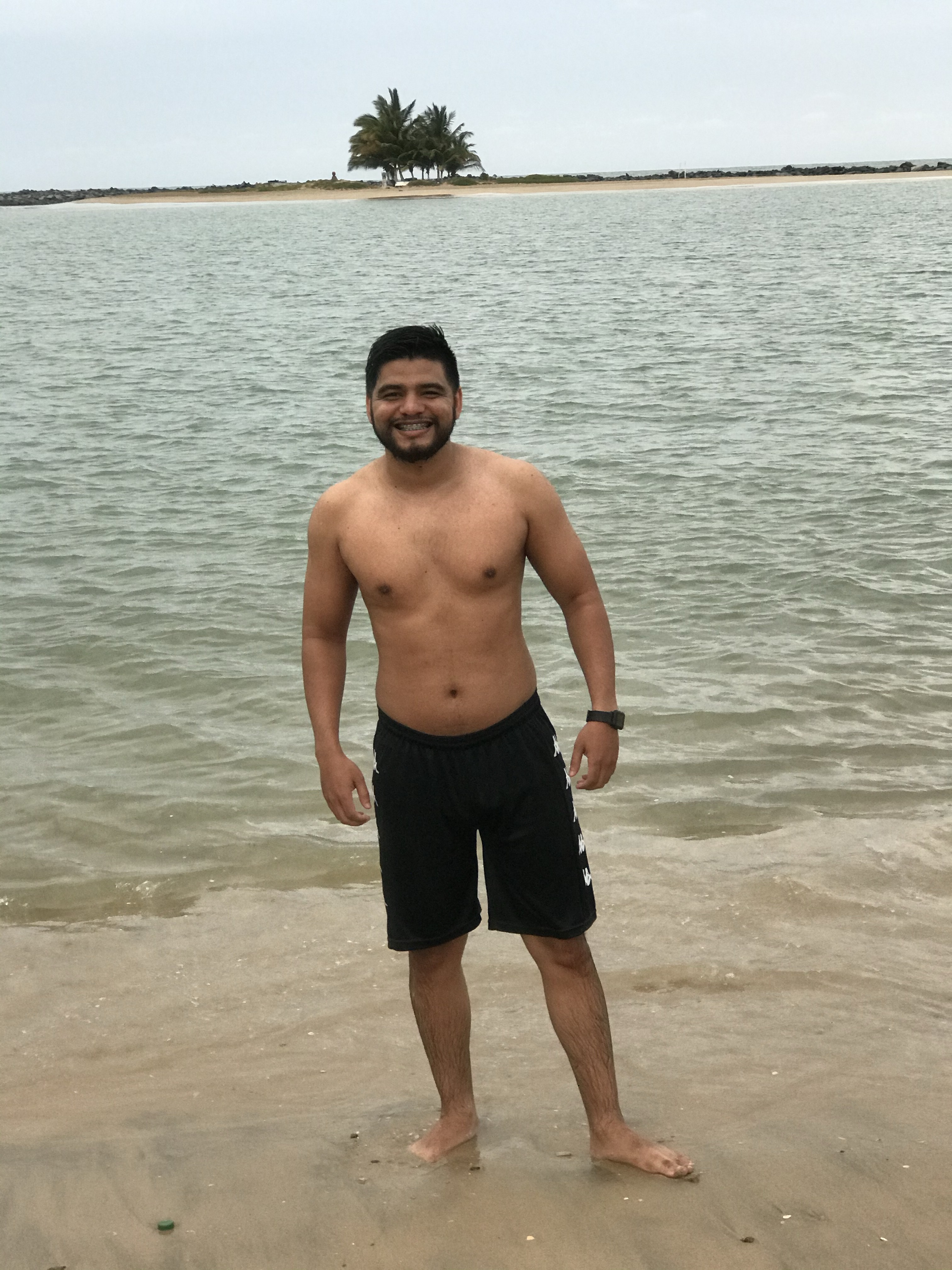 Foto de antes - evolução do paciente 4