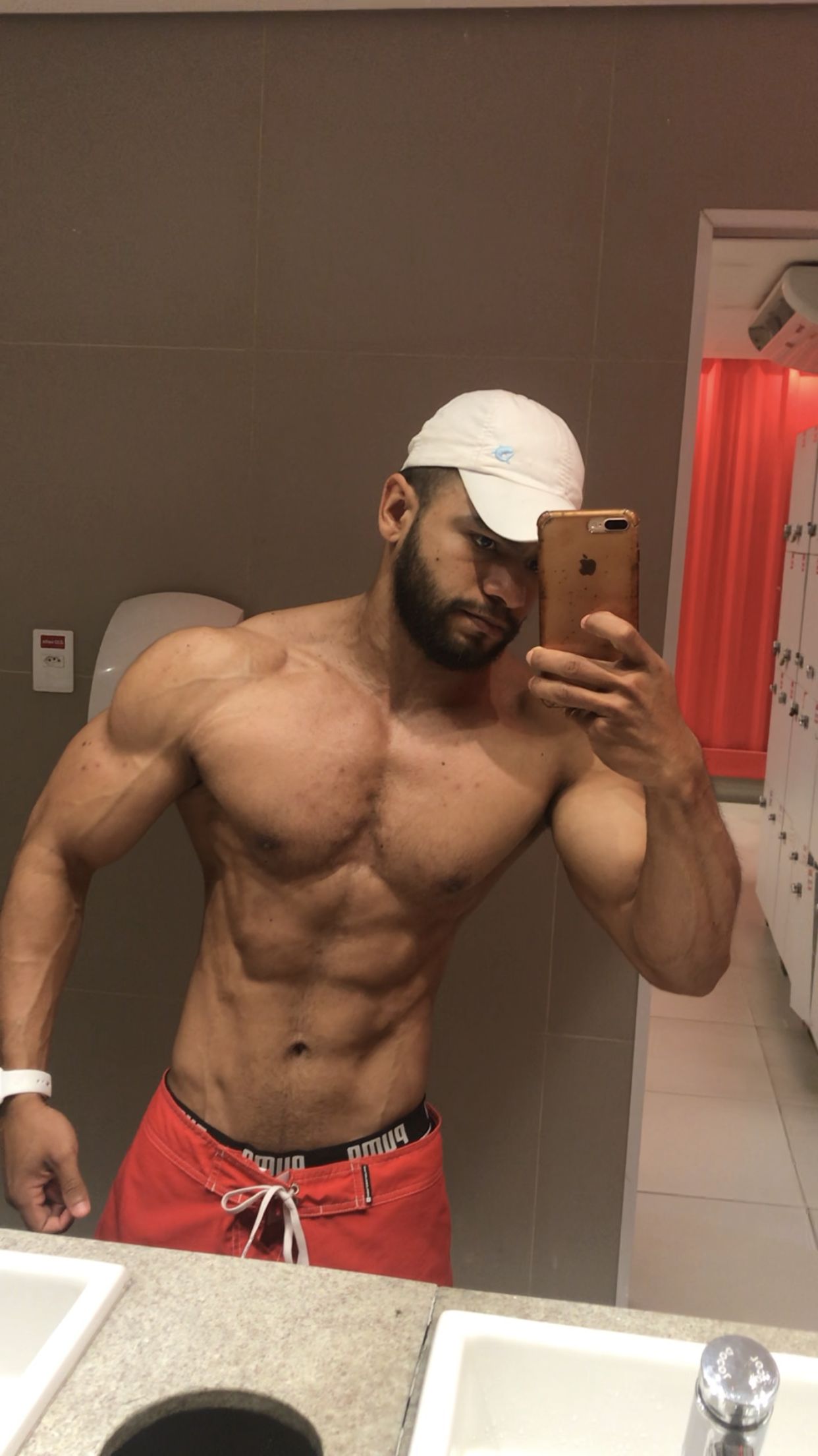 Foto de depois - evolução do paciente 4